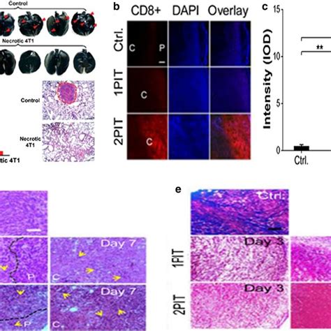 A Quantitative Analysis Of Lung Metastases And H E Staining Of Lung