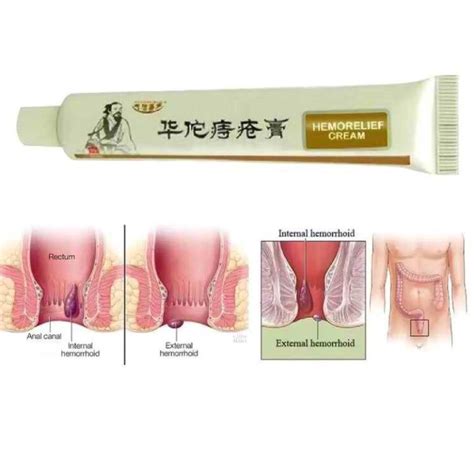 Huatuo Hemorrhoids Cream Lazada Ph