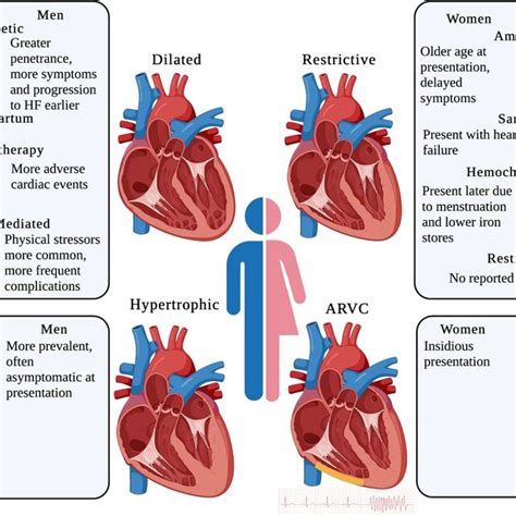 Sex Differences In The Four Main Types Of Cardiomyopathies There Are Download Scientific