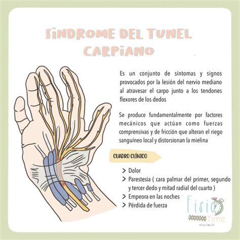 Sindrome Del Tunel Carpiano YUDOC ORG UDocz