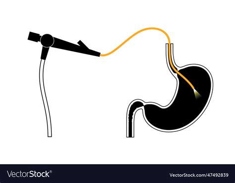 Gastroscopy Endoscopy Procedure Royalty Free Vector Image