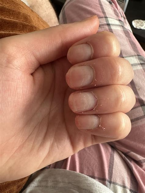 Advice Needed Cuticles How Do I Fix These And Make Them Look Nice