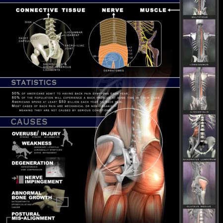 Shoulder Pain Poster Real Bodywork