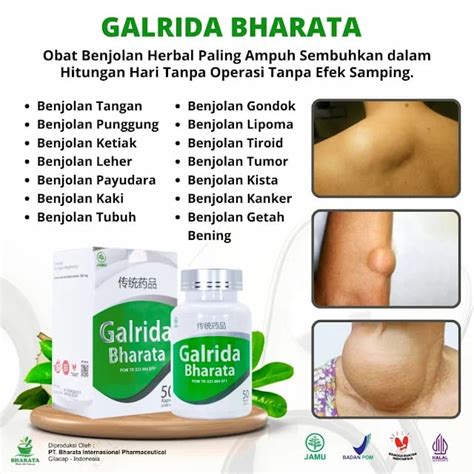 Galrida Bharata Obat Herbal Benjolan Lipoma Gondok Tumor Jinak Kelenjar