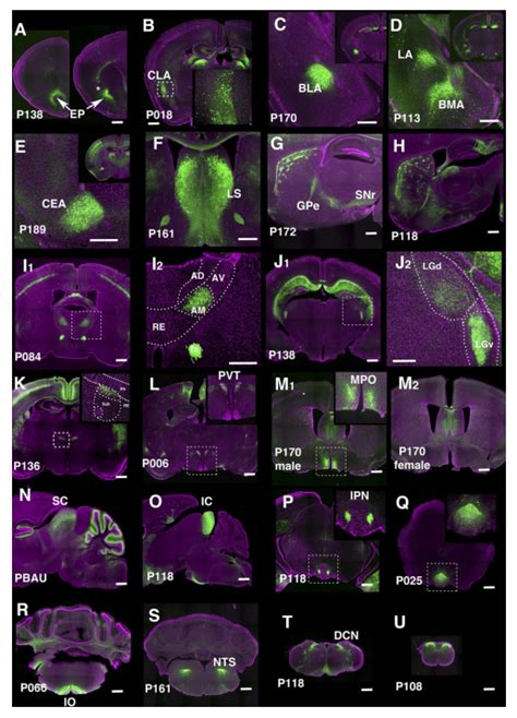 Trapping Individual Cell Types In The Mouse Brain