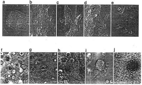 Figure 5 From The Importance Of The Microenvironment In Breast Cancer