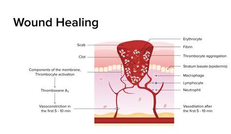 Wound Healing | Concise Medical Knowledge