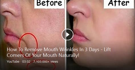 Drooping Mouth Corner” Instantly Makes A Person Appear 10 Years Older