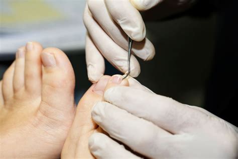 10 Signs Of Disease Your Feet Can Reveal Reader S Digest