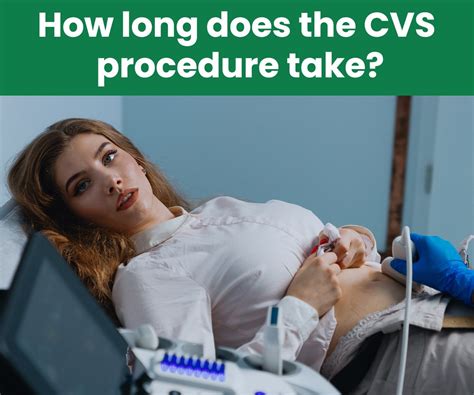 how long does it take to develop photos at cvs
