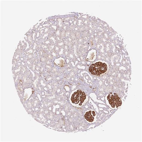 New Map Tracks Protein Expression In Human Ti EurekAlert