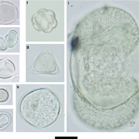 Images Of Common Pollen Grains Sampled At The Different Heights Over