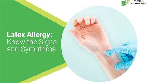 Latex Allergy Know The Signs And Symptoms