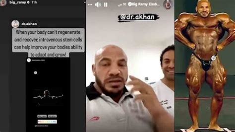 Big Ramy Receives Stem Cell Treatment For Damaged Nerves Ahead Of