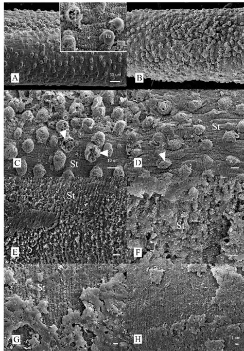 Scanning Electron Micrographs Of Male A D And Female E H S Mansoni Download Scientific