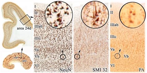 Anterior Cingulate Cortex Pain, Function & Damage | Human Cingulate Cortex