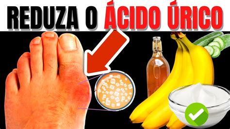 10 Melhores Alimentos Para Evitar A Gota E Baixar O Ácido Úrico Alto Do Sangue E Os 10 Piores