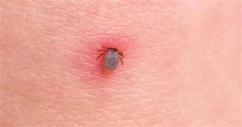 What are the 8 most common diseases carried or caused by ticks ...