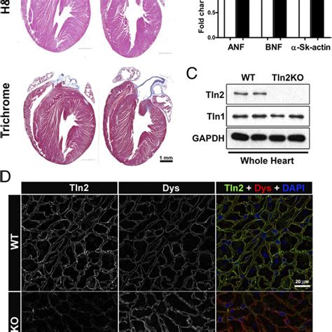 Tln Ko Shows No Alterations In Myocardial Structure Hypertrophic