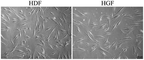 Human Gingival Fibroblasts Possess A Similar Cell Morphology To Human