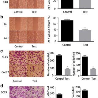 High Expression Of Hsa Circ 0055538 Promotes Apoptosis In OSCC Cells