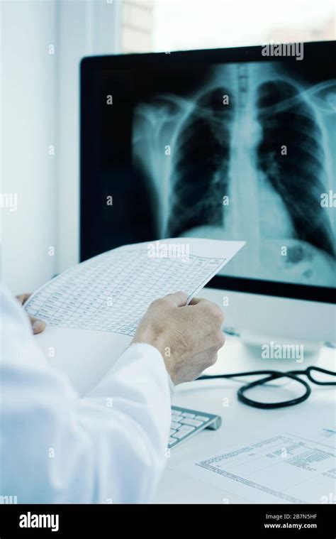 Radiografia Del Torace Immagini E Fotografie Stock Ad Alta Risoluzione