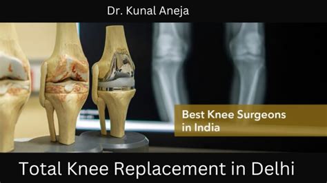 Expert Total Knee Replacement In Delhi Dr Kunal Aneja