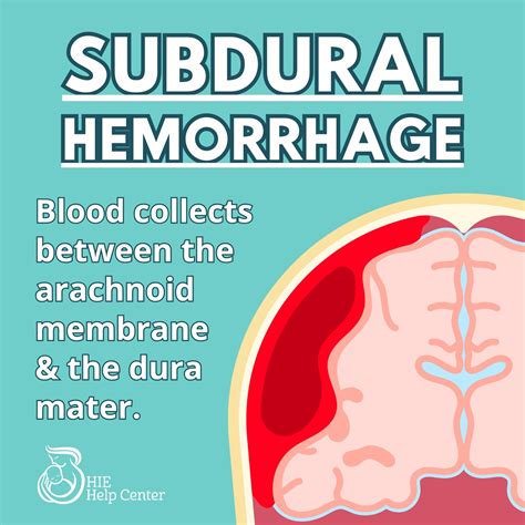 Intracranial Hemorrhages Brain Bleeds And Birth Injuries