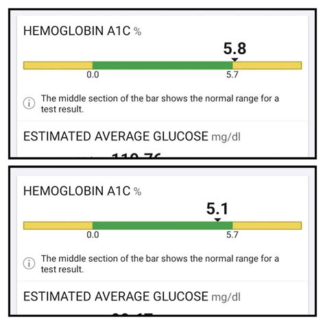 Pejjsisjs on Twitter: "RT @DaveEDanna: A1C 5.8 to 5.1 Blood Pressure 140/87 to 126/77 Glucose ...