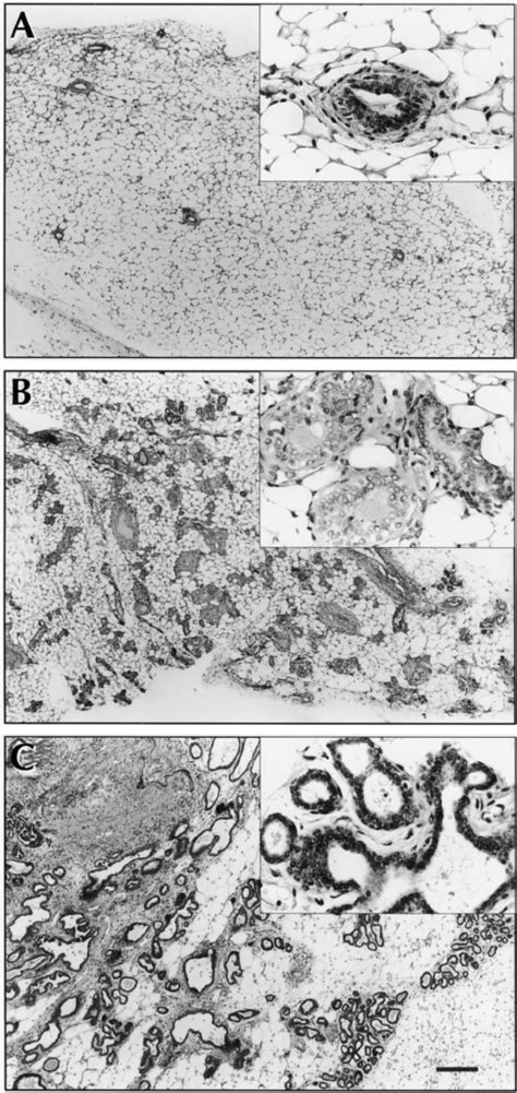 Histological Analysis Of Female Mammary Glands Expressing Tg Wnt 1 With