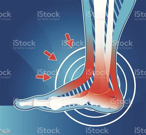 Nyeri Pada Sendi Ilustrasi Stok Unduh Gambar Sekarang Rasa Sakit