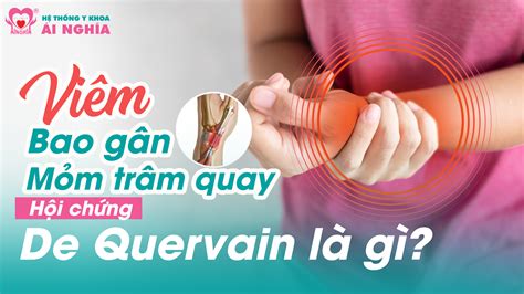 Viêm Bao gân mỏm trâm quay Hội chứng De Quervain là gì Hệ Thống Y