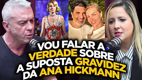 Ana Hickmann Est Gr Vida Do Talarico Edu Guedes Youtube