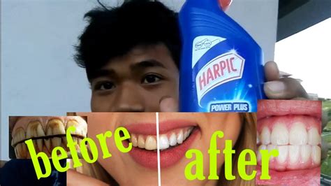 Best Way To Whiten Your Teeth At Home With Easy Method Youtube