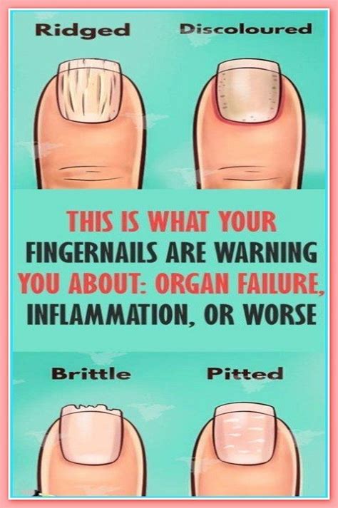 8 Important Signs Your Fingernails Can Tell About Your Health Artofit