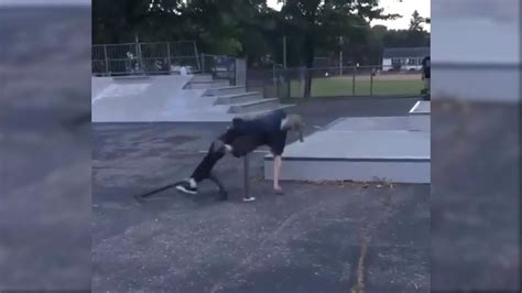 Really Painful Skateboarding Fail YouTube