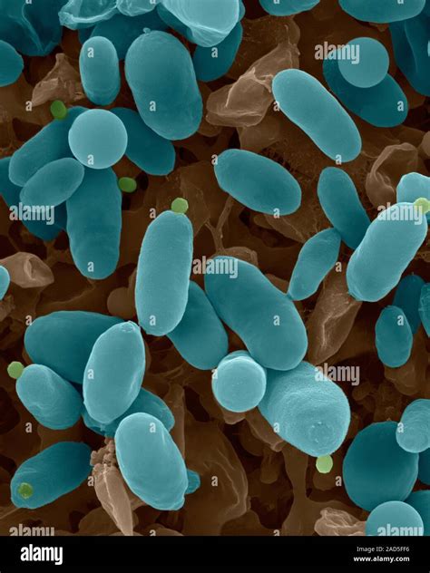 Coloured Scanning Electron Micrograph Sem Of Pigmented False Yeast