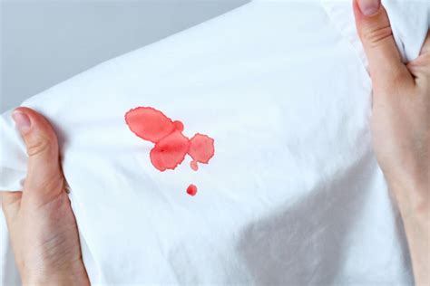 How To Remove Blood Stains From Clothes A Practical Guide