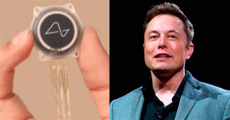 Elon Musk S Neuralink Will Begin Tests On Humans To Implant Brain Chips