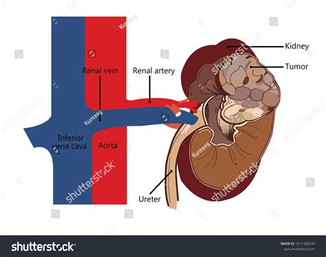 Anatomy Drawing Version Cartoon About Human Stock Illustration ...