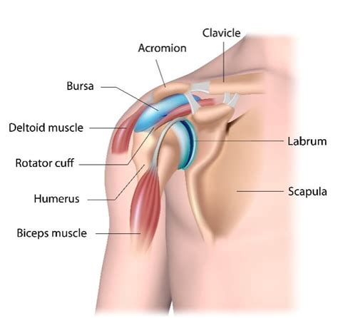 Subacromial Bursitis: Causes, Symptoms, and Treatments