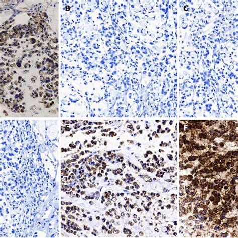 Immunohistochemical Staining Characteristics A Immunohistochemical