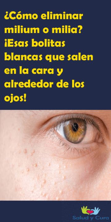 Por Que Te Salen Bolitas En Los Ojos Consejos Ojos