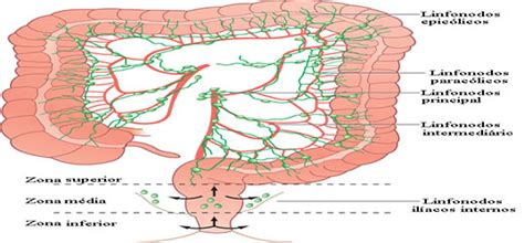 Cancer Colorretal Colonoscopia Coloproctologia Endoscopia