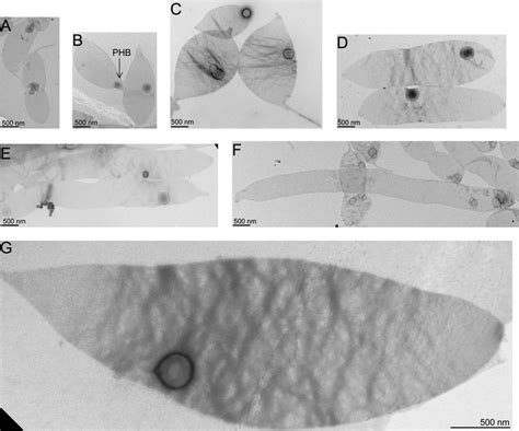 Transmission Electron Micrographs Of C Crescentus Sacculi Isolated At