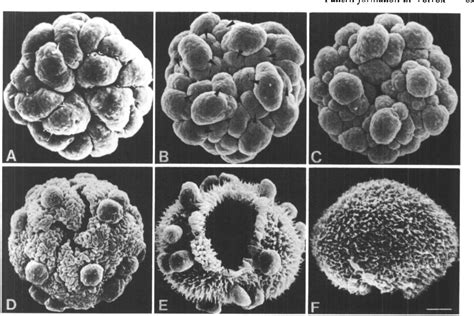 Figure 2 From Genetic And Cytological Control Of The Asymmetric