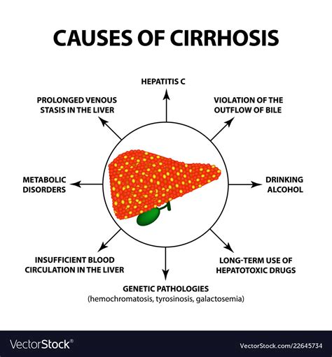 Hepatic Cirrhosis Causes Symptoms And Treatment – NBKomputer