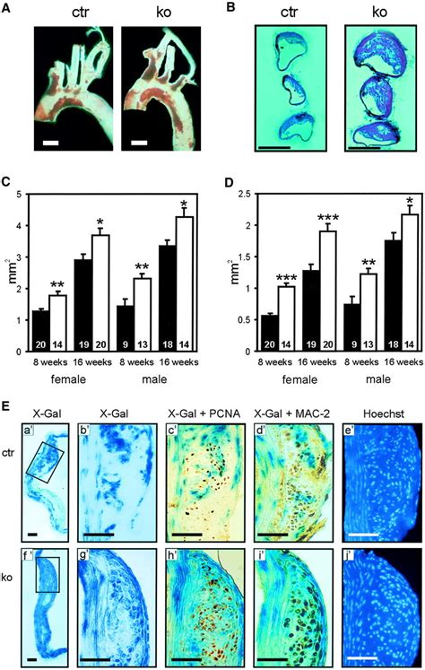 Sm22α Modulates Vascular Smooth Muscle Cell Phenotype During