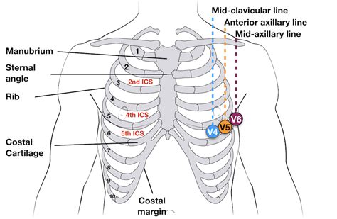 ECG Lead positioning • LITFL Medical Blog • ECG Library Basics Med Student, Mnemonics, Fire ...