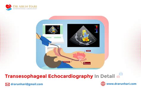 Transesophageal Echocardiography In Detail Dr Arun Hari